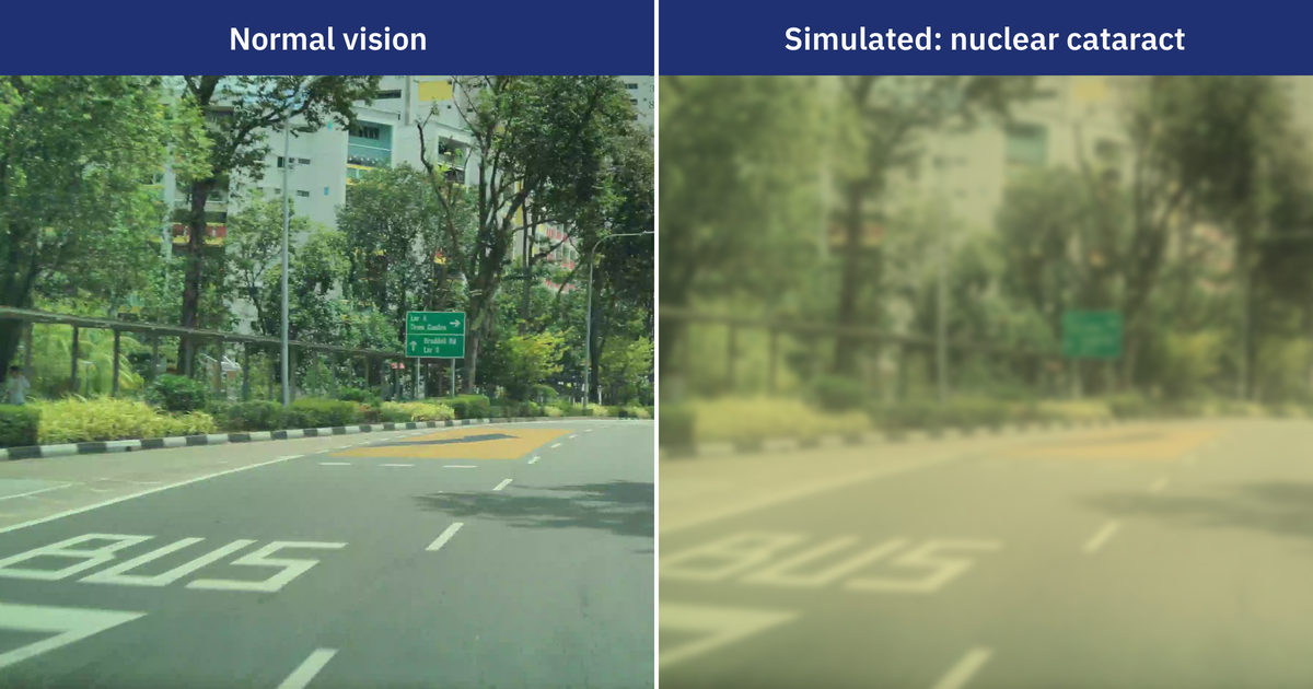 Normal vision beside simulated cataract vision: the same view of a Singapore road, the right half yellowed and hazy with a nuclear cataract, its green destination sign no longer readable.